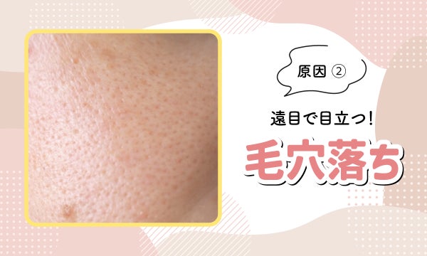 原因②遠目で目立つ!毛穴落ち