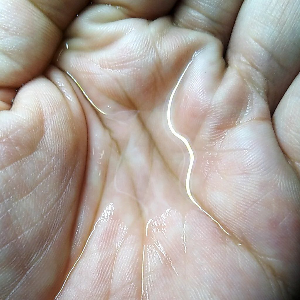 ティーツリーバイオームブレミッシュシカトナー/MEDIHEAL/化粧水を使ったクチコミ（2枚目）