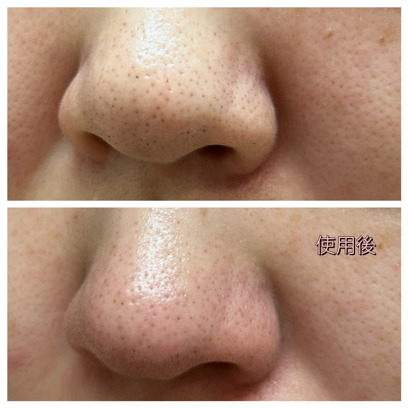 クレンジングバーム ブラック/CLAYGE/クレンジングバームを使ったクチコミ（3枚目）