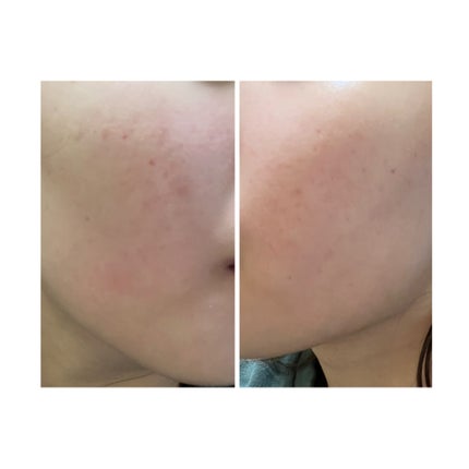 を使ったクチコミ(1枚目)