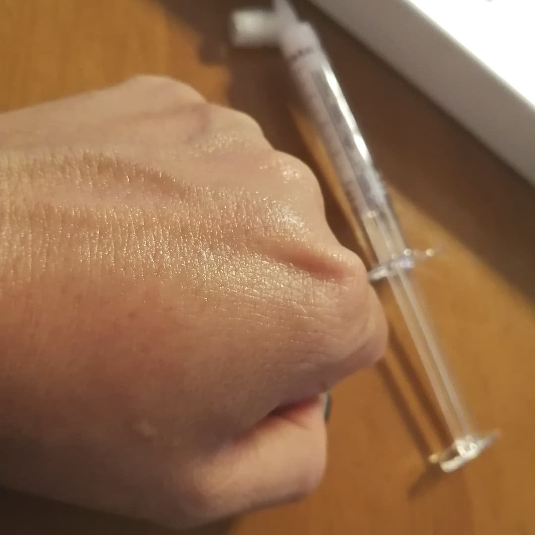 ビトック フォー デイリー RX/Differ&Deeper/美容液を使ったクチコミ(5枚目)