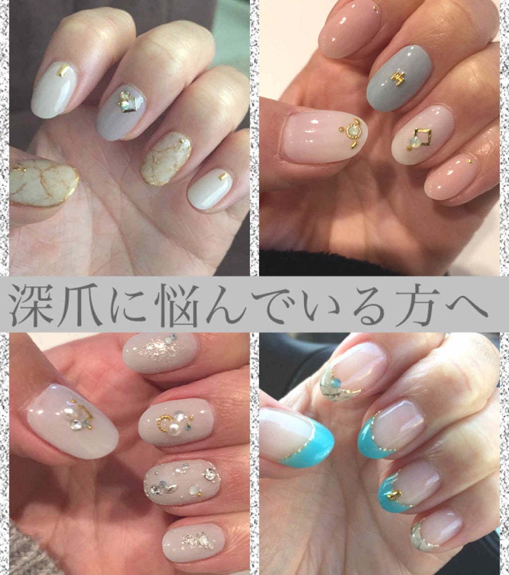 たらちゃん☆follow back100 on LIPS 「深爪でお悩みの方…治ります。わたしは治りました。過去にも書いた..」(1枚目)