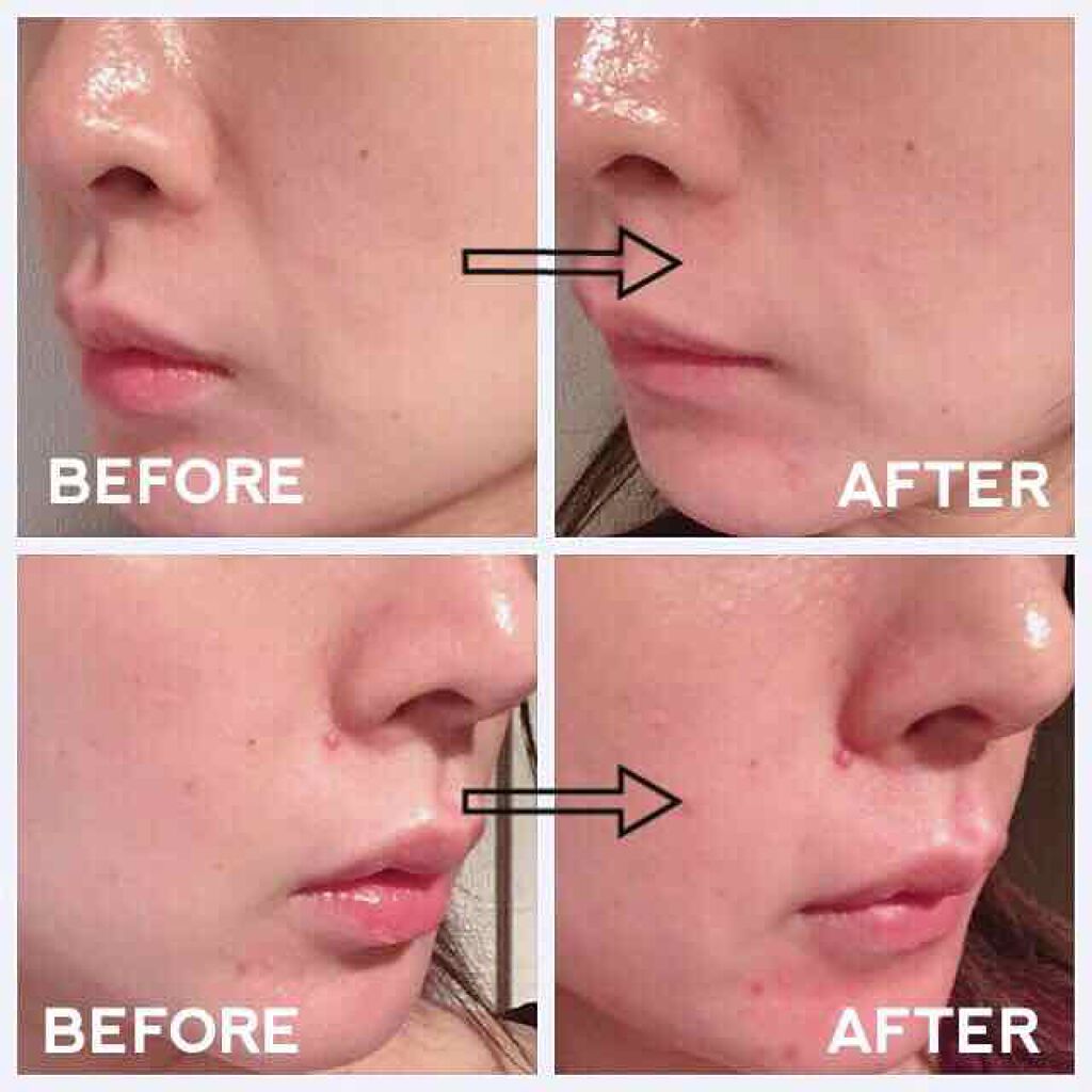 I'M FILL PATCH(アイムフィルパッチ)/I'Mシリーズ/シートマスク・パックを使ったクチコミ(2枚目)