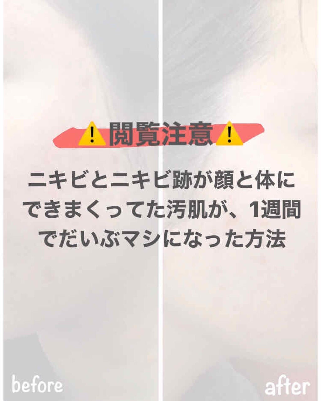 潤浸保湿 フェイスクリーム/キュレル/フェイスクリームを使ったクチコミ(1枚目)