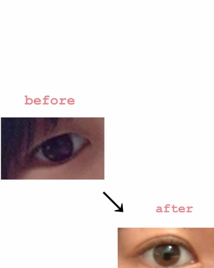 アイテープ(絆創膏タイプ、レギュラー、70枚)/DAISO/二重まぶた用アイテムを使ったクチコミ(2枚目)