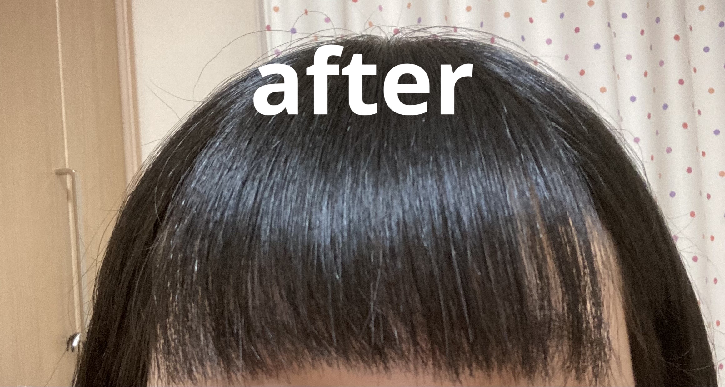 縮毛矯正セット（ショート・部分用）/プロカリテ/その他を使ったクチコミ（3枚目）