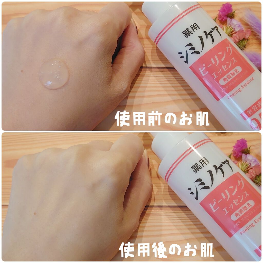 薬用シミノケアピーリングエッセンス/ミリオナ化粧品/ピーリングを使ったクチコミ(4枚目)