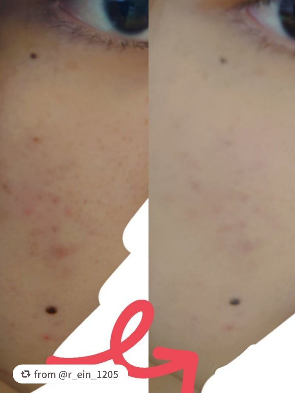 マシュマロフィニッシュパウダー/キャンメイク/プレストパウダーを使ったクチコミ(4枚目)