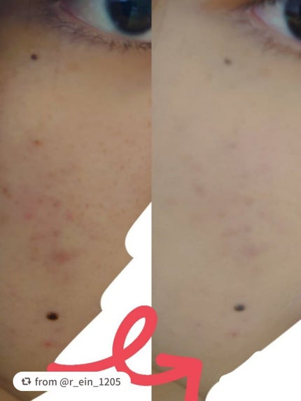 マシュマロフィニッシュパウダー/キャンメイク/プレストパウダーを使ったクチコミ(4枚目)