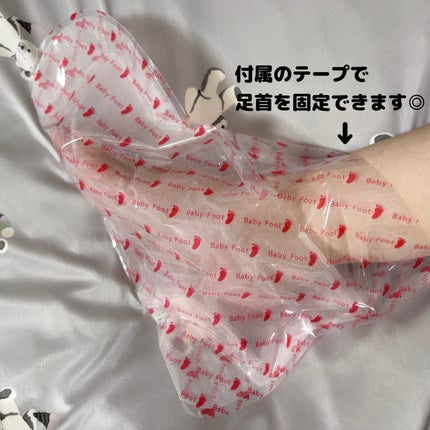 ベビーフット 重曹殺菌消毒洗浄剤/ベビーフット/レッグ・フットケアを使ったクチコミ(3枚目)