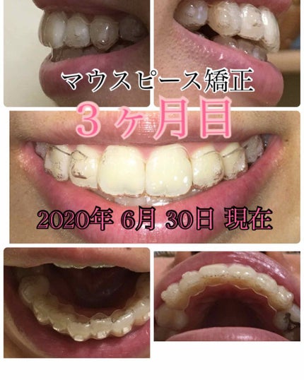 を使ったクチコミ(1枚目)