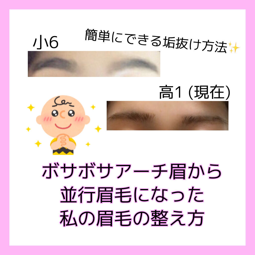 脱色クリーム 敏感肌用/エピラット/ムダ毛ケアを使ったクチコミ（1枚目）