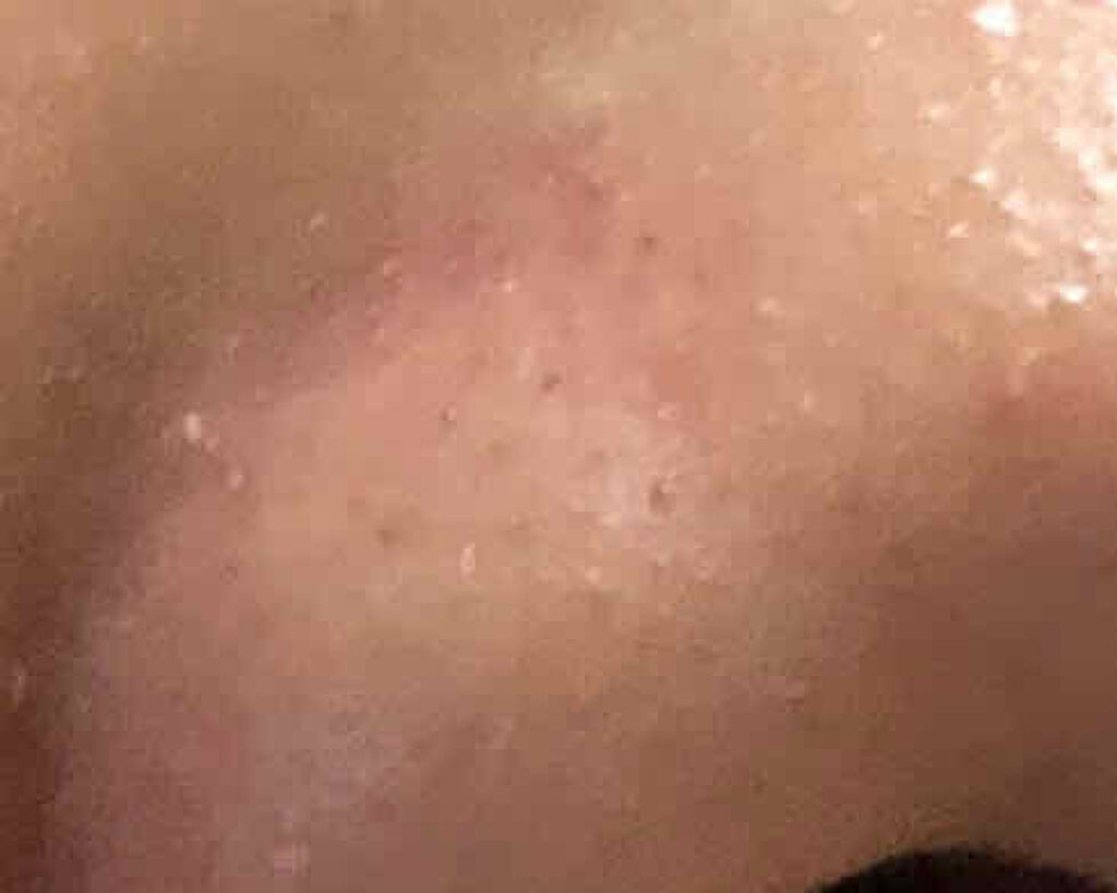 A アクネフォーム/NOV/洗顔フォームを使ったクチコミ（2枚目）