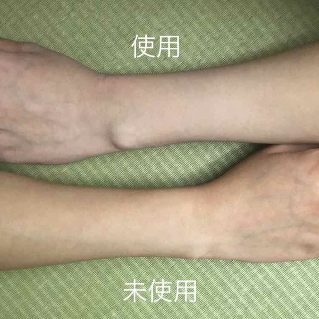 薬用ホワイトコンク ホワイトニングCC CII/ホワイトコンク/ボディクリームを使ったクチコミ（2枚目）