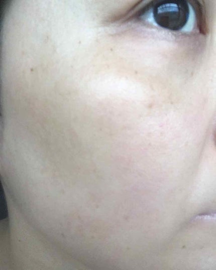 オリジナル ピュアスキンジェリー/ヴァセリン/ボディクリームを使ったクチコミ(1枚目)