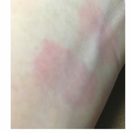 カバーパーフェクション チップコンシーラー/the SAEM/リキッドコンシーラーを使ったクチコミ(2枚目)