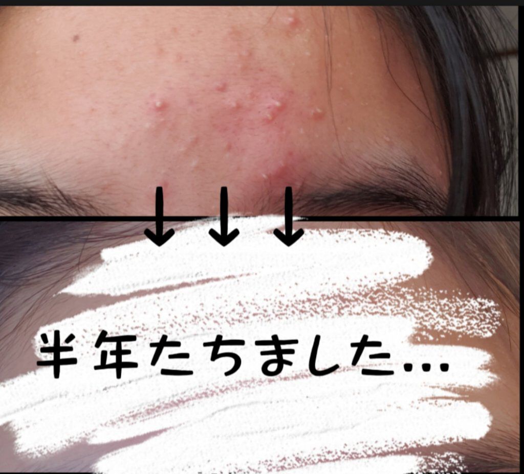 明色美顔水 薬用化粧水/美顔/化粧水を使ったクチコミ(1枚目)