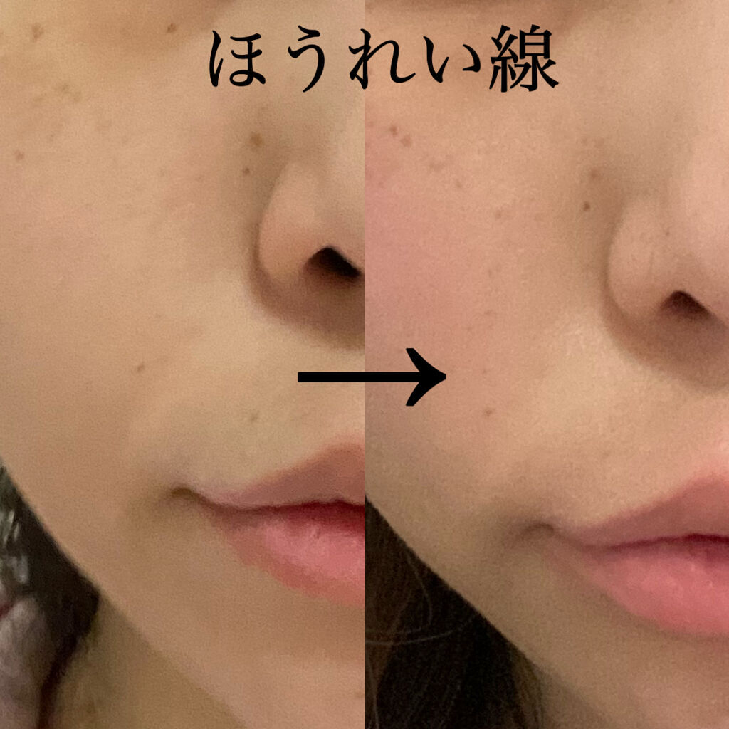 エイジングケア 薬用リンクルケアクリームマスク 無印良品の効果に関する口コミ エイジングケアにおすすめのフェイスクリーム ほうれい線 クマ 顔の By りな 敏感肌 30代前半 Lips