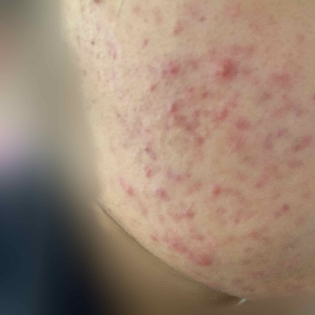 ワンステップオリジナルクリアパッド/COSRX/トナーパッドを使ったクチコミ（3枚目）