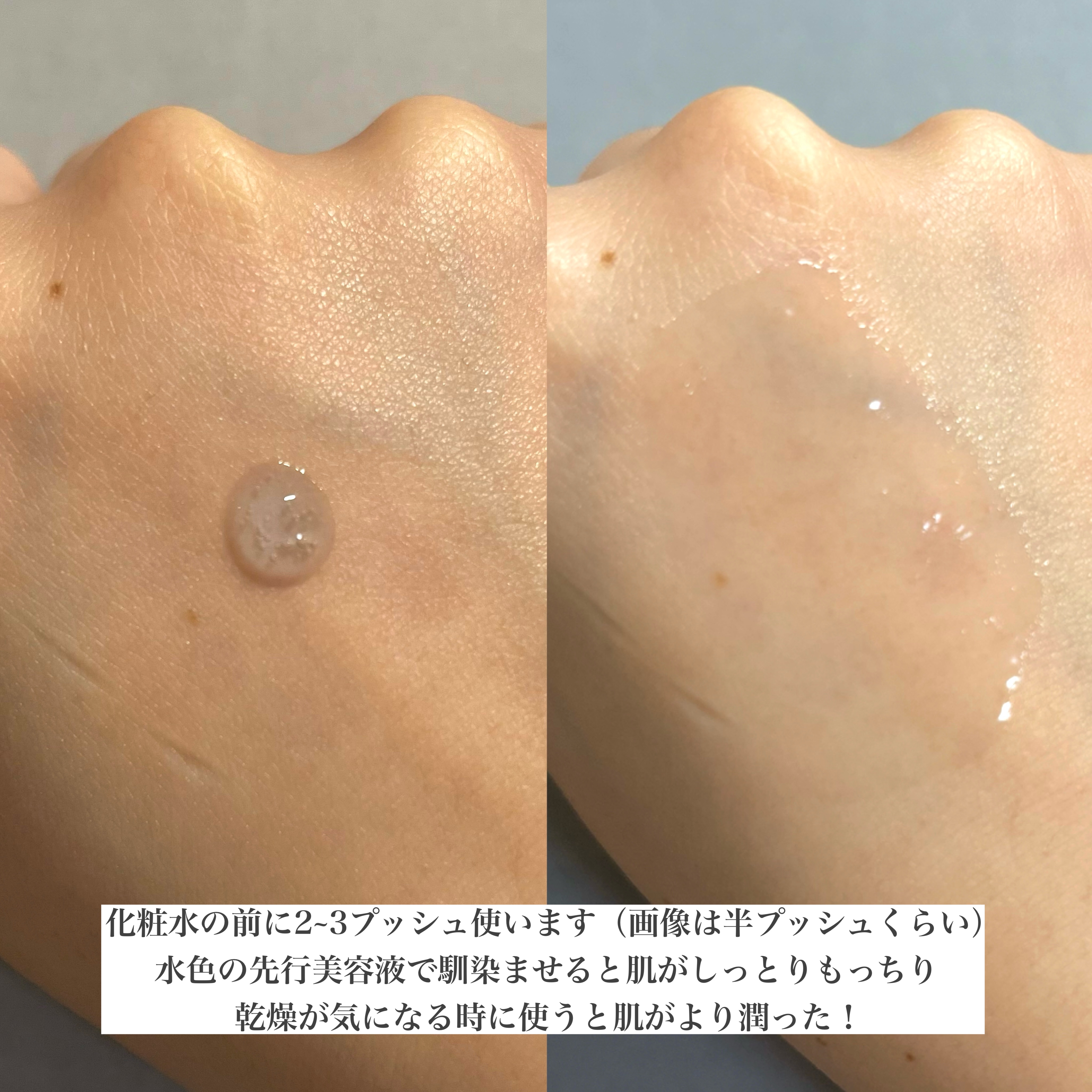 ディープブーストセラム/ブルーミオ/美容液を使ったクチコミ（2枚目）