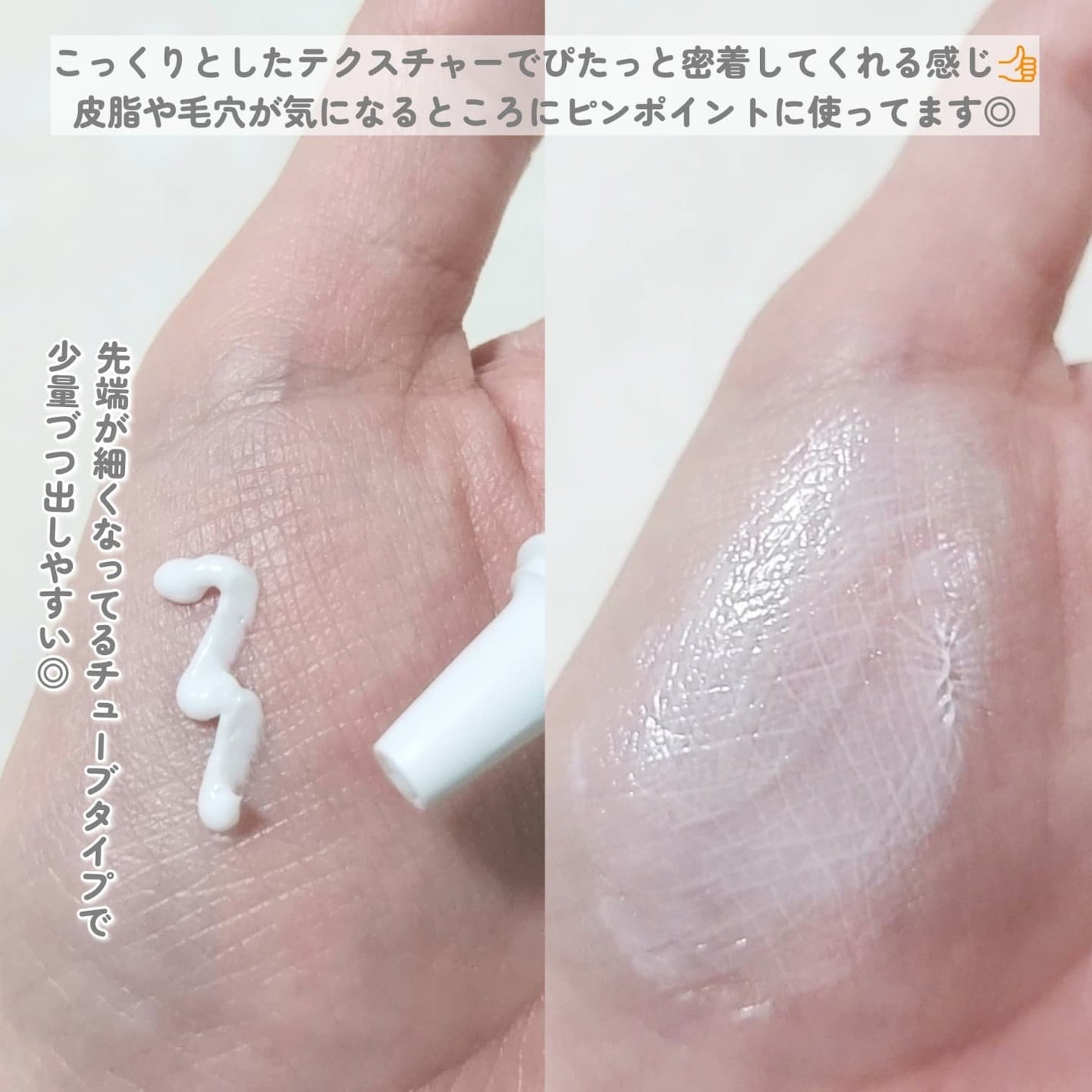 ダーマセプトRX AZAセラム/ダーマセプトRX/美容液を使ったクチコミ(3枚目)