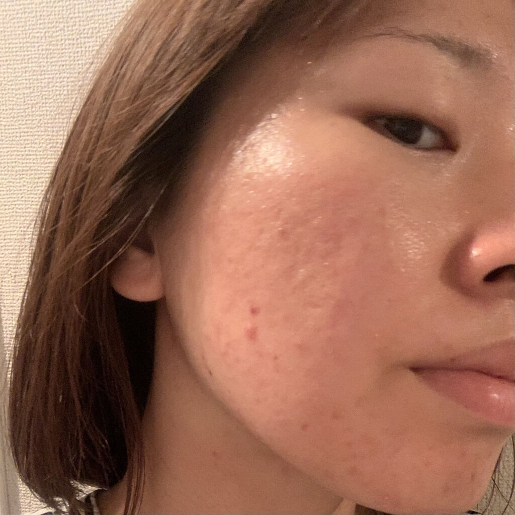 ハトムギ浸透乳液(ナチュリエ スキンコンディショニングミルク)/ナチュリエ/乳液を使ったクチコミ（3枚目）