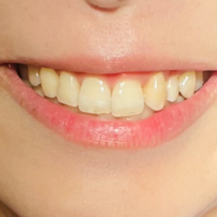 Dr.オーラル 3Dホワイトニングパウダー(プライムミント)/Dr.Oral/歯磨き粉を使ったクチコミ(3枚目)