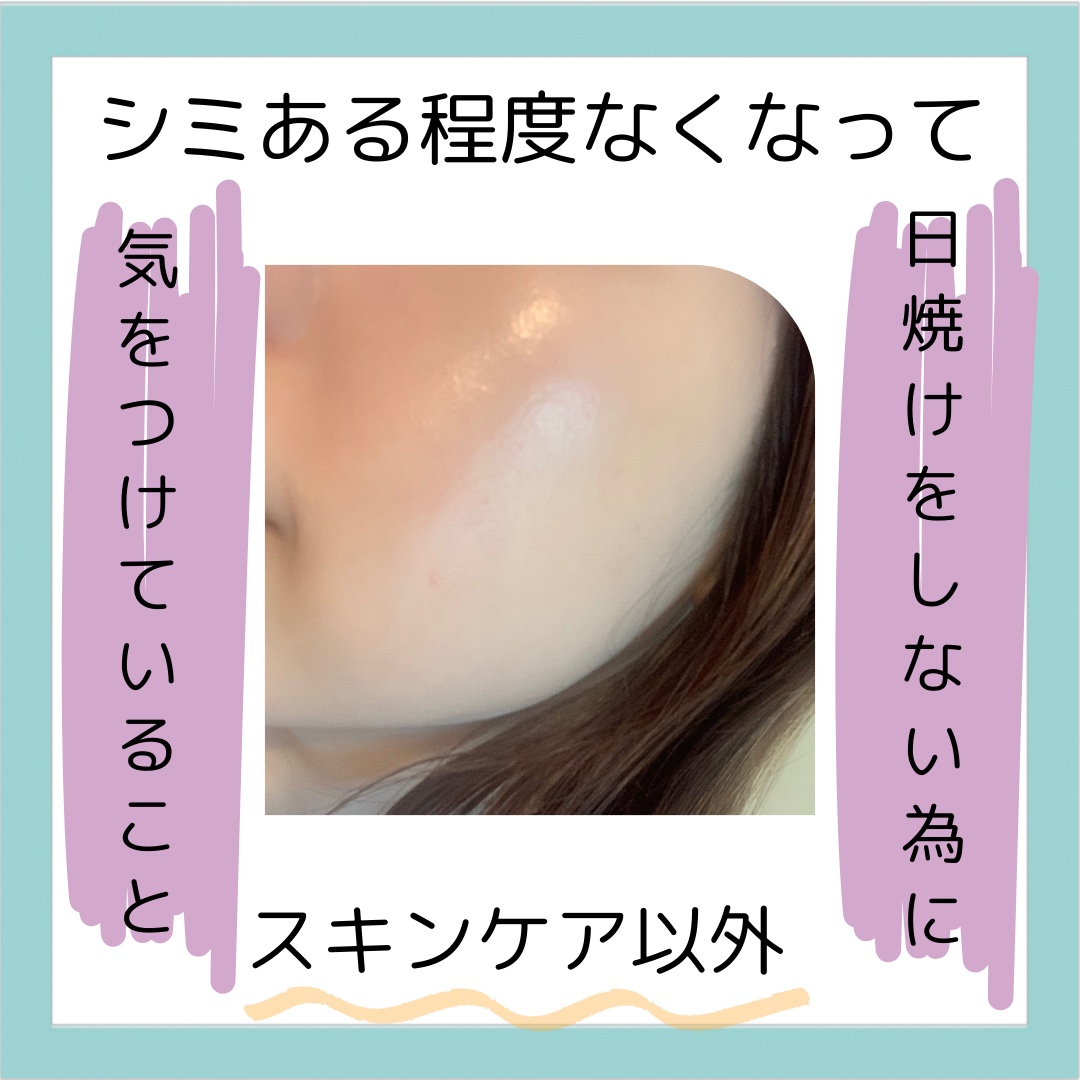 100%完全遮光 日傘/Rose Blanc/日傘を使ったクチコミ（1枚目）