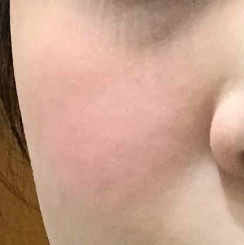 ブライトアップチークN/media/パウダーチークを使ったクチコミ（3枚目）