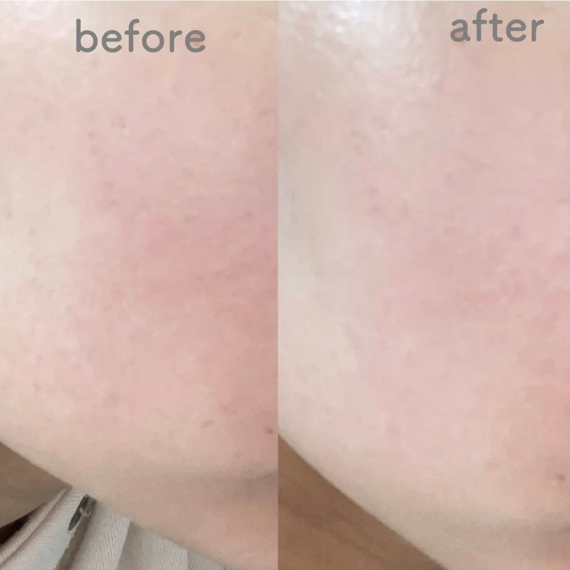 UVã€ã㢠XL ãããã¯ã·ã§ã³ããŒã³ã¢ãã ããŒãº/ã© ããã·ã¥ ããŒ/æ¥çŒãæ¢ãã¯ãªãŒã ã䜿ã£ãã¯ãã³ãïŒ3æç®ïŒ