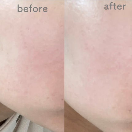 UVã€ã㢠XL ãããã¯ã·ã§ã³ããŒã³ã¢ãã ããŒãº/ã© ããã·ã¥ ããŒ/æ¥çŒãæ¢ãã¯ãªãŒã ã䜿ã£ãã¯ãã³ãïŒ3æç®ïŒ