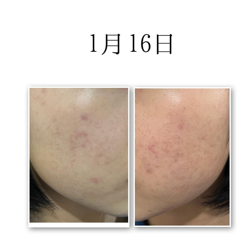 ハトムギ化粧水(ナチュリエ スキンコンディショナー R )/ナチュリエ/化粧水を使ったクチコミ(2枚目)