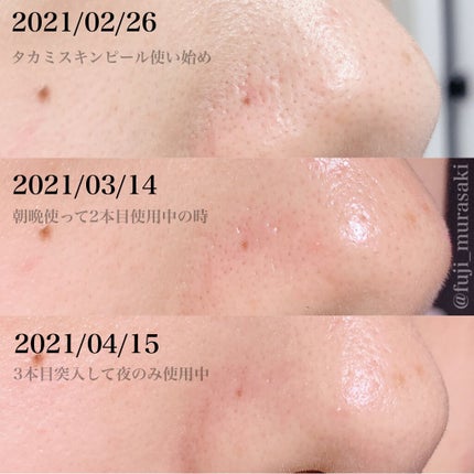 タカミスキンピール/タカミ/ブースター・導入液を使ったクチコミ(6枚目)