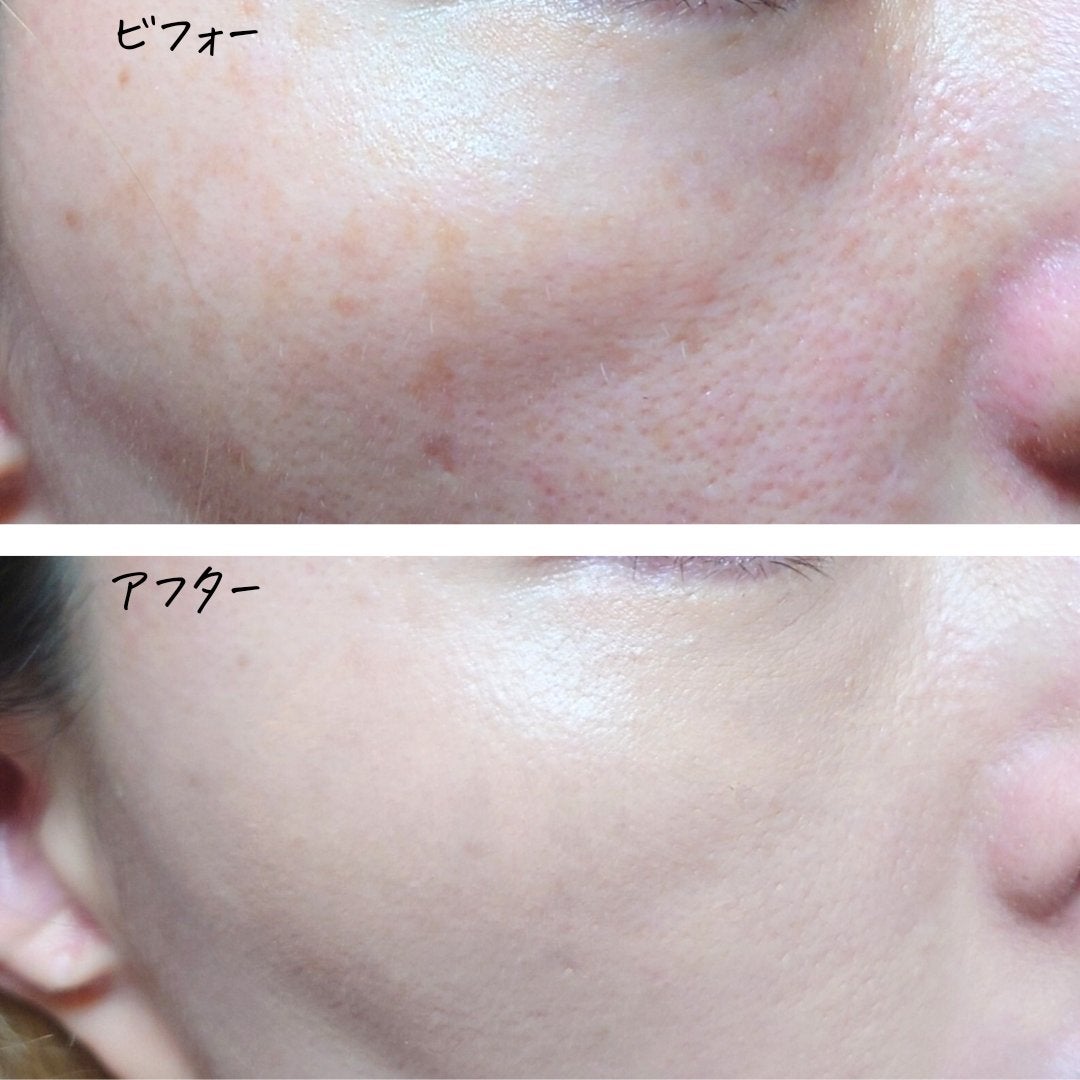 薬用 美白美容液ファンデ(医薬部外品)/HAKU/クリーム・エマルジョンファンデーションを使ったクチコミ(4枚目)