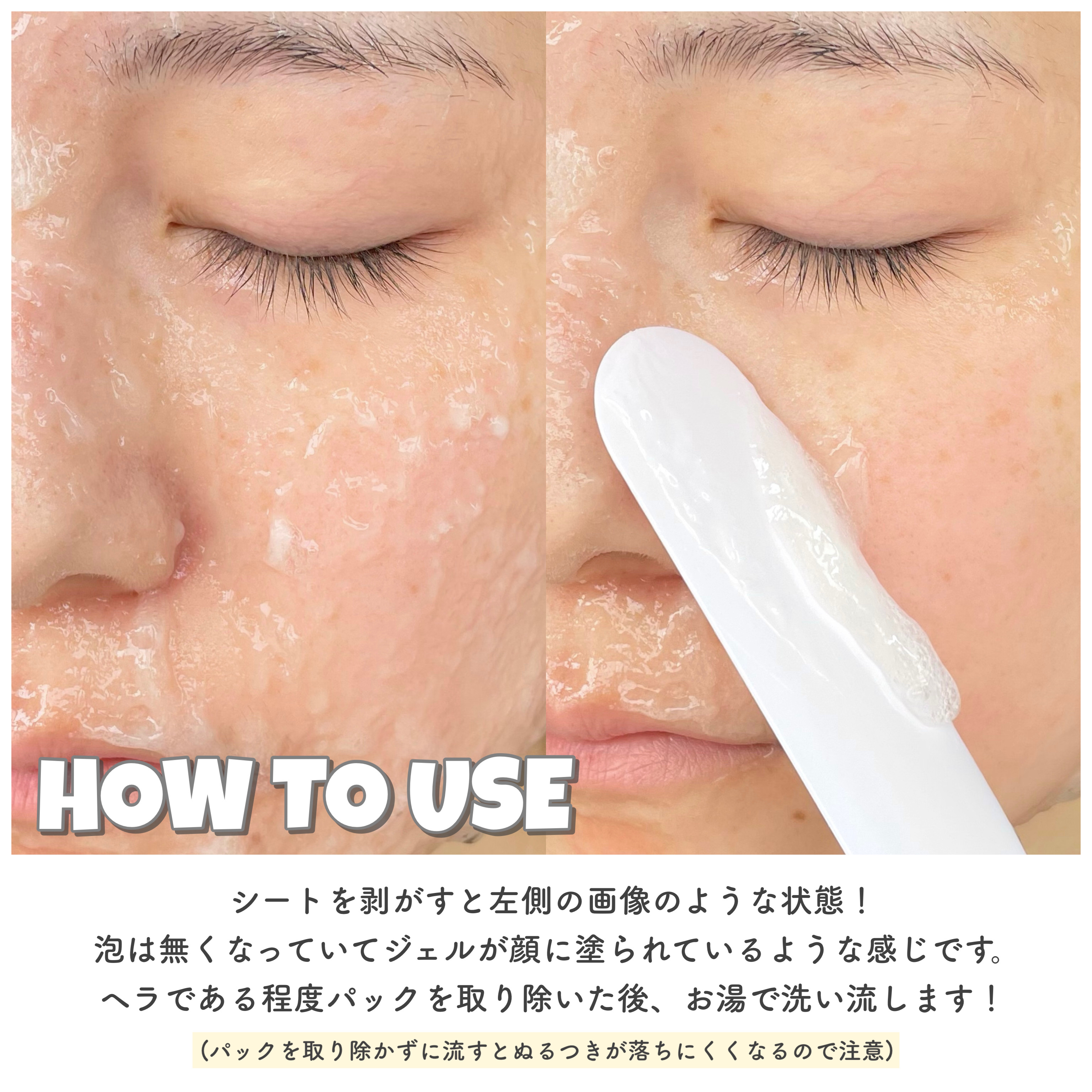 urar ユレイル炭酸パック 5セット 付属品無し スパークリングパック