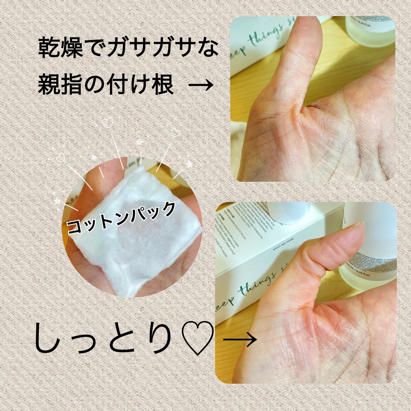 ドクダミ 77 スージングトナー/Anua/化粧水を使ったクチコミ(2枚目)