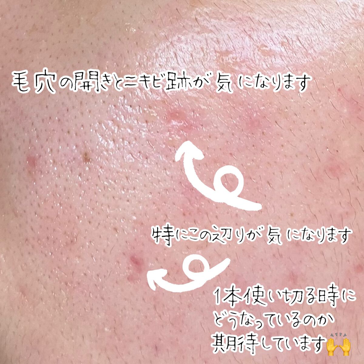 DS RTN リニューイング セラム/Kiehl's/美容液を使ったクチコミ(3枚目)