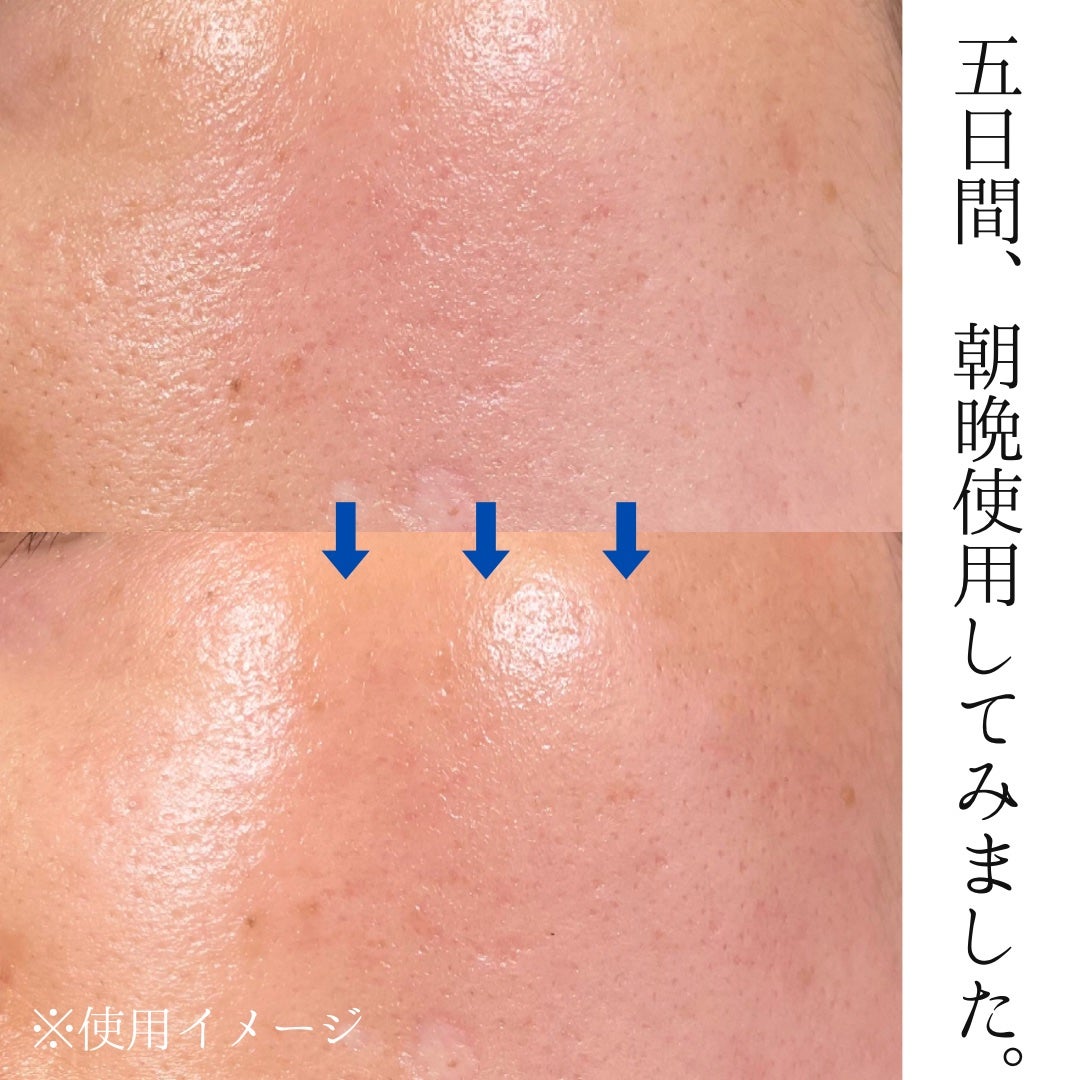 ザクロビタミンC美白アンプル/NATURAL DERMA PROJECT/美容液を使ったクチコミ(1枚目)