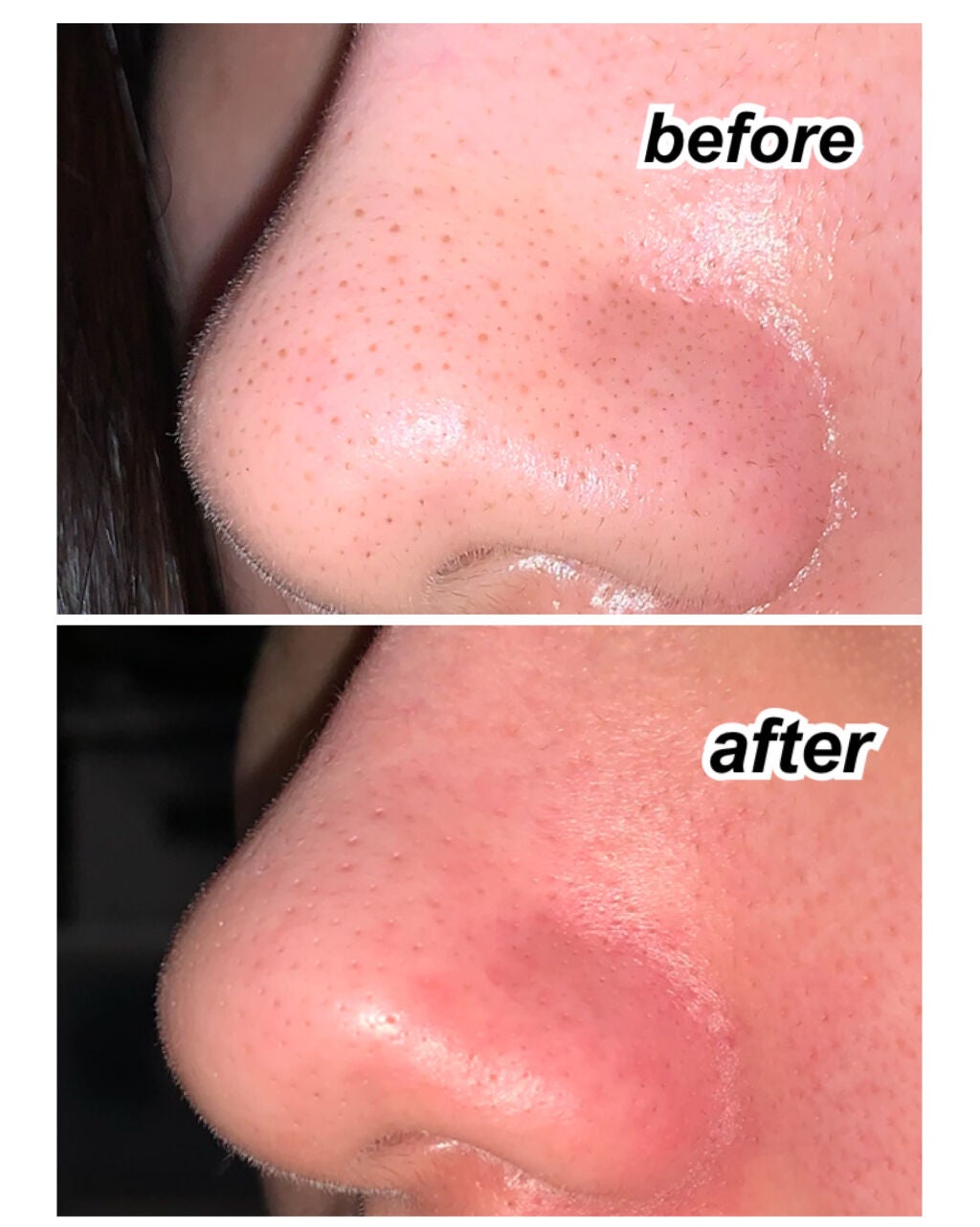 ノーモアブラックヘッド(ノーズピーリング)/One-day's you/スクラブ・ゴマージュを使ったクチコミ(2枚目)