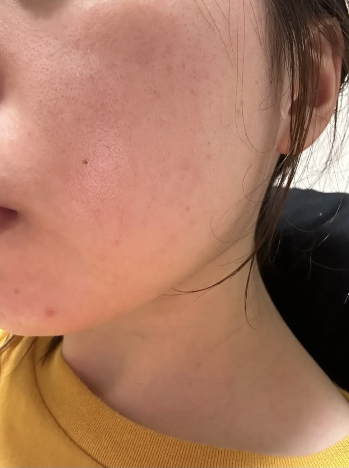 薬用しみ集中対策 プレミアム美容液/メラノCC/美容液を使ったクチコミ（3枚目）