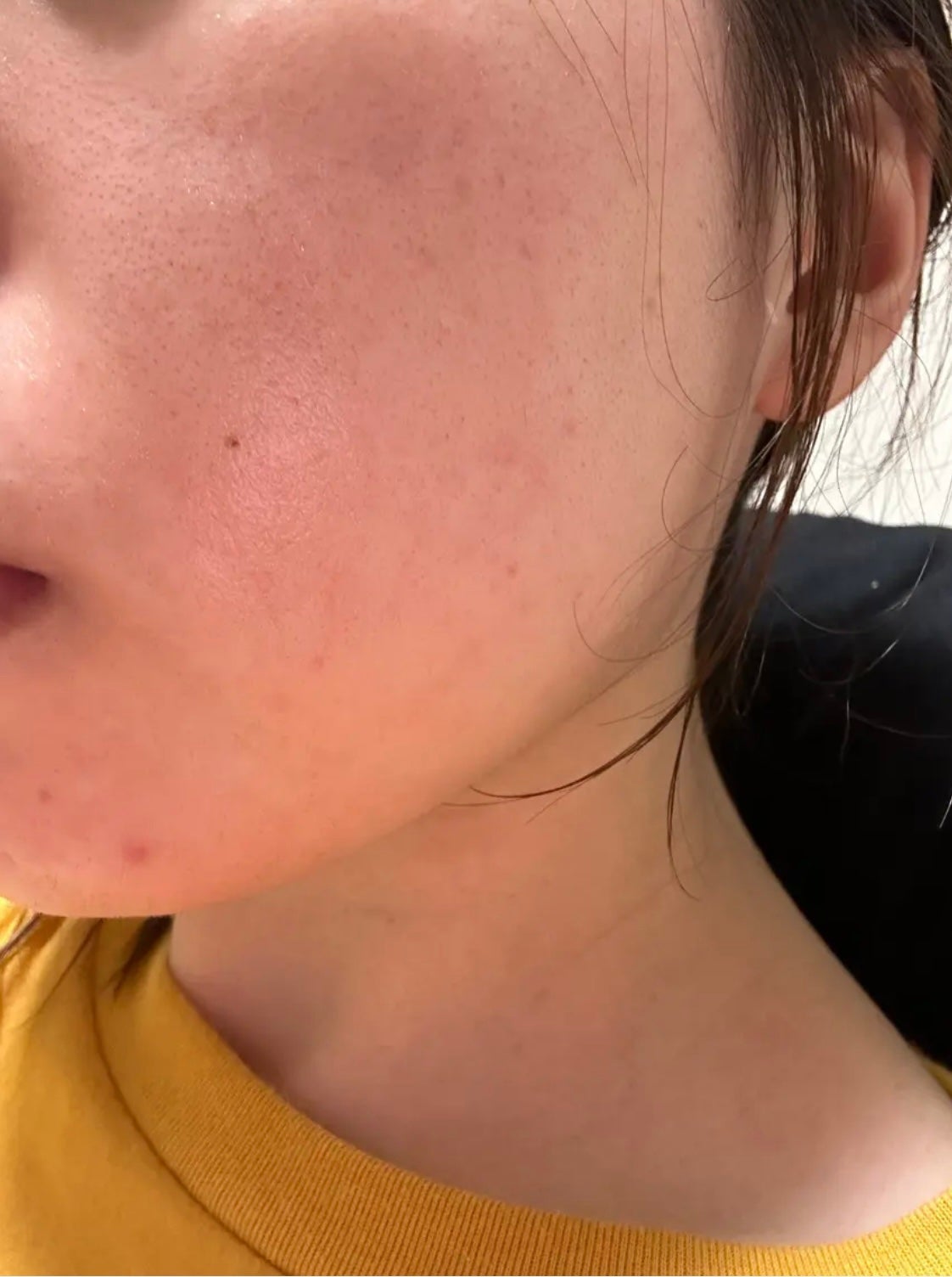 薬用しみ集中対策 プレミアム美容液/メラノCC/美容液を使ったクチコミ(3枚目)