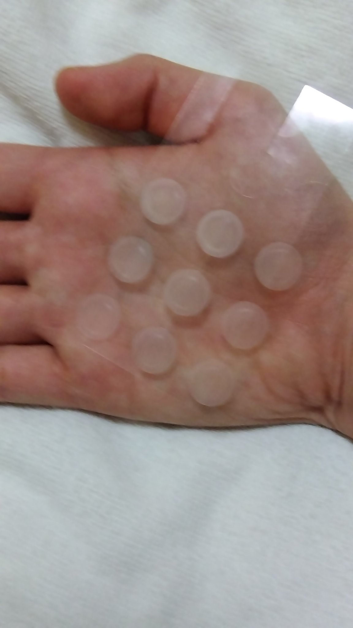 プロCICA クリアスポットパッチ/VT/その他スキンケアを使ったクチコミ（2枚目）