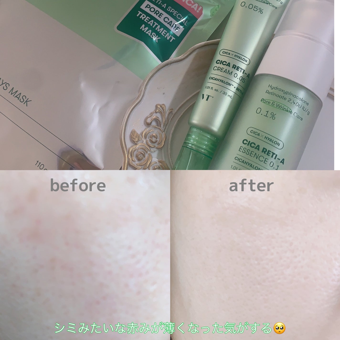 シカレチA エッセンス0.1/VT/美容液を使ったクチコミ(5枚目)