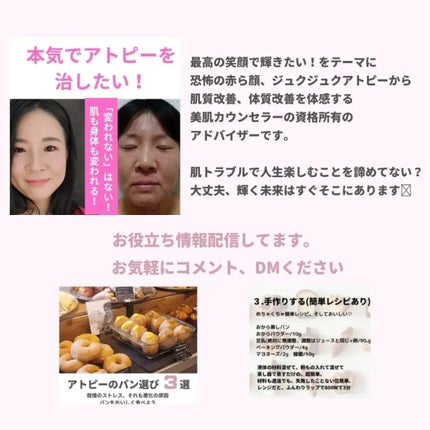 美肌カウンセラー💆肌悩みを解決し見る世界を変える on LIPS 「アトピーを乗りこえた先にある"誰もが手に入れたい陶器肌"それを..」(9枚目)