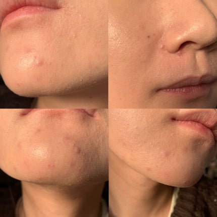 ピンクティーツリーカバークッション/APLIN/クッションファンデーションを使ったクチコミ(7枚目)