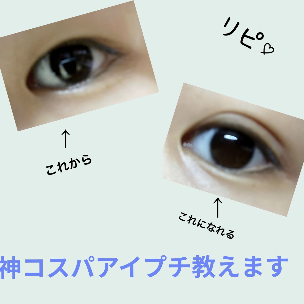 のびーるアイテープ（絆創膏タイプ、レギュラー）/DAISO/二重まぶた用アイテムを使ったクチコミ（1枚目）