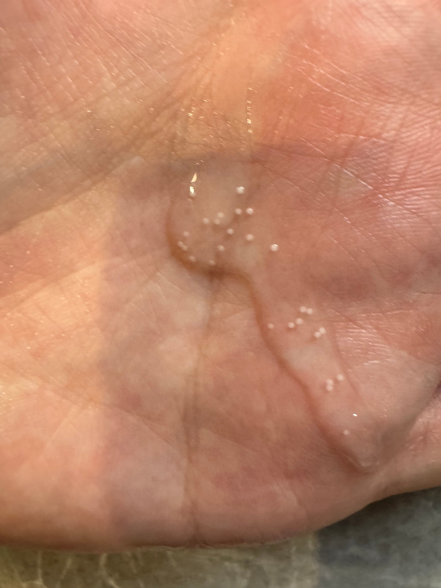 トーンブライトニング カプセルアンプル/SKIN1004/美容液を使ったクチコミ(4枚目)