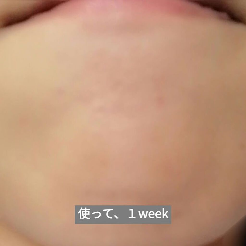 ハトムギ化粧水(ナチュリエ スキンコンディショナー R )/ナチュリエ/化粧水を使ったクチコミ（3枚目）