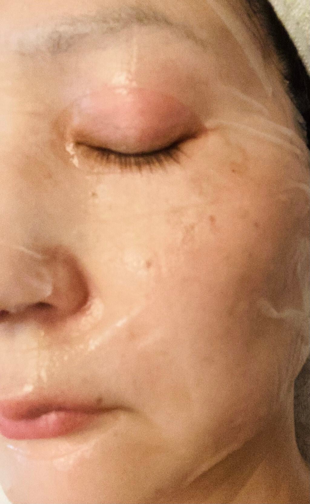 H9 ヒアルロニック アンプルマスク/JMsolution/シートマスク・パックを使ったクチコミ(6枚目)