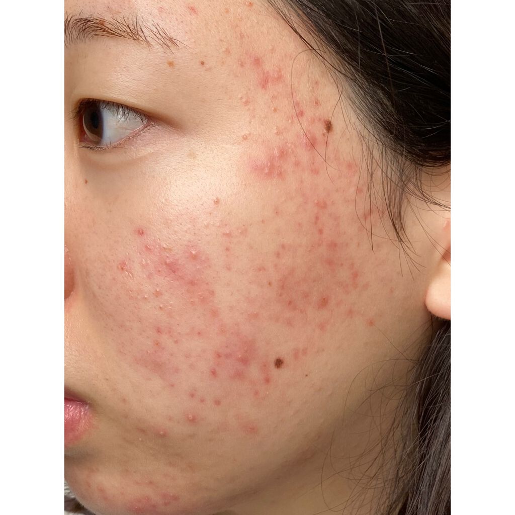 u on LIPS 「お久しぶりの投稿🦦ここ最近、本当に肌すごいことになっててやっぱ..」(1枚目)